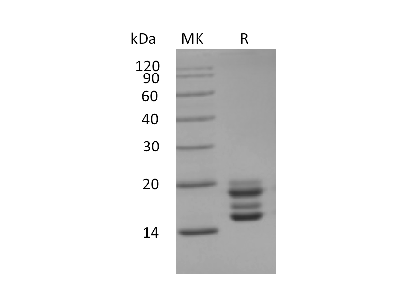 Recombinant Human IL-17A (C-6His)
