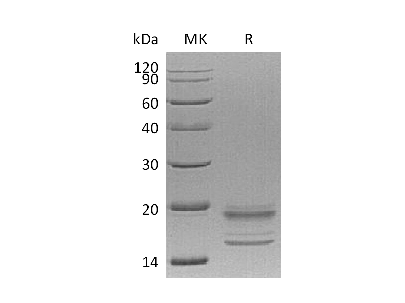 Recombinant Human IL-17A&17F (C-6His)