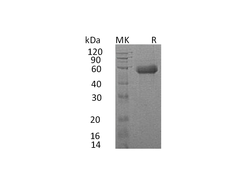 Recombinant Human IL-18RAcP (C-6His)
