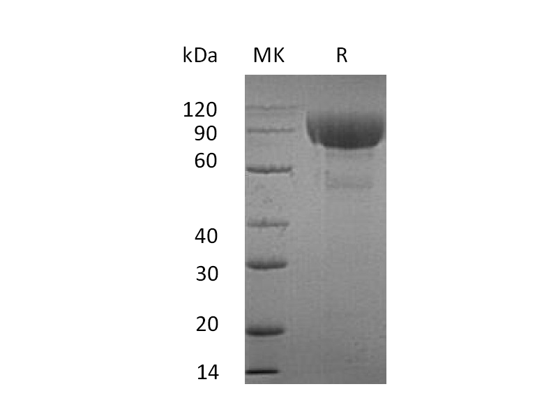 Recombinant Human IL-1RL2 (C-Fc)