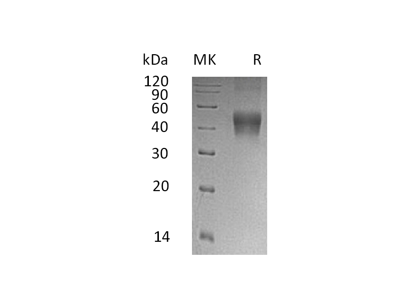 Recombinant Human IL-21R (C-6His)