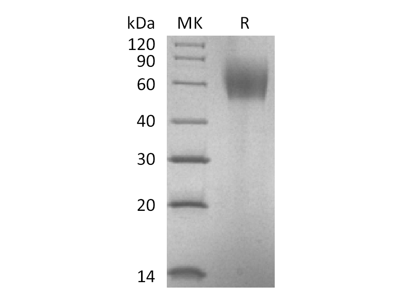 Recombinant Human IL-23R (C-6His)