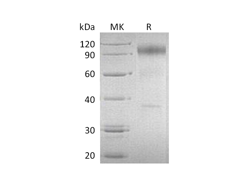 Recombinant Human IL-23R (C-Fc)