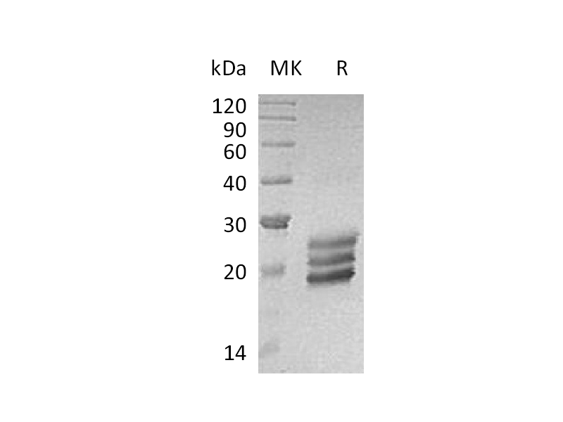 Recombinant Human IL-25 (C-6His)