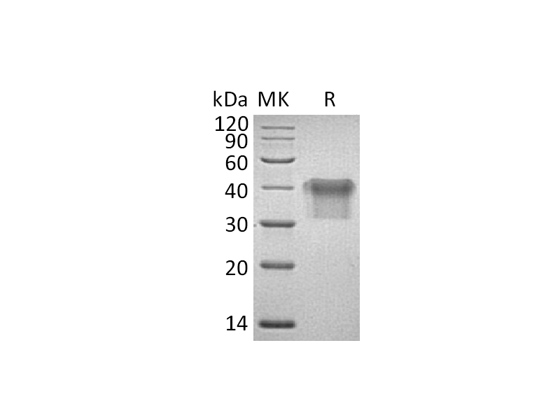 Recombinant Human IL-2RA (C-6His)