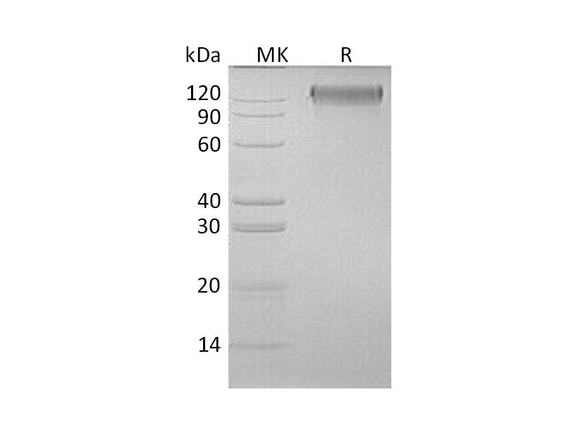 Recombinant Human OSMRB (C-6His)