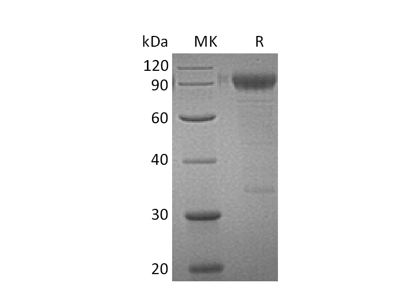 Recombinant Human IL-3RA (C-Fc)