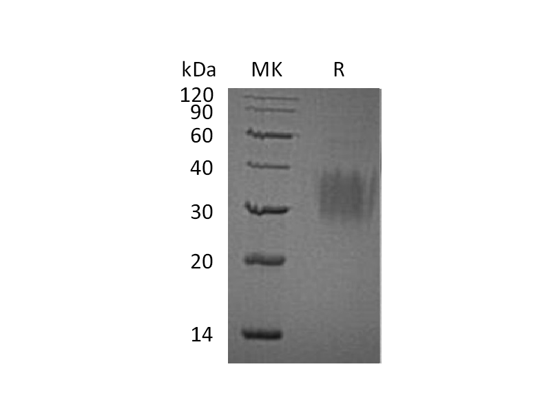 Recombinant Human IL-9 (C-6His)