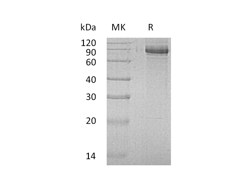 Recombinant Human INPP1 (C-6His)