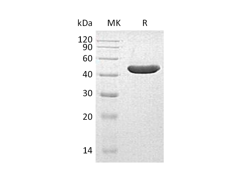 Recombinant Human INPP5A (C-6His)