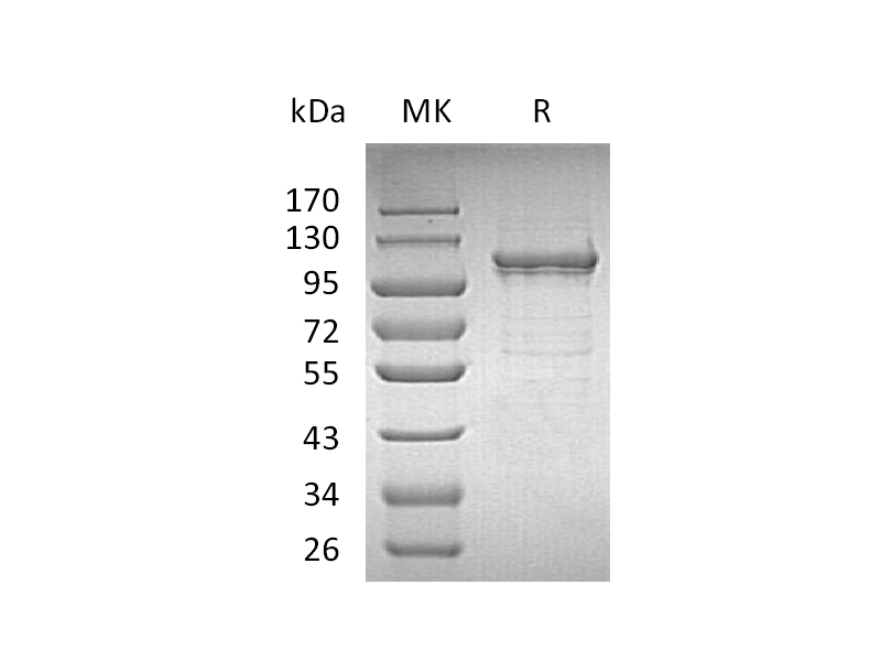 Recombinant Human IDE (C-6His)
