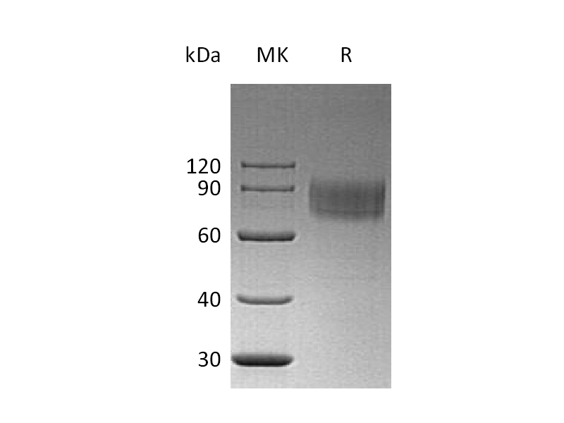 Recombinant Human IFNAR1 (C-6His)