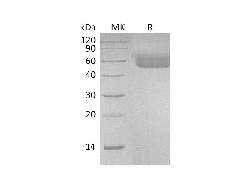 Recombinant Human IL-1R1 (C-6His)