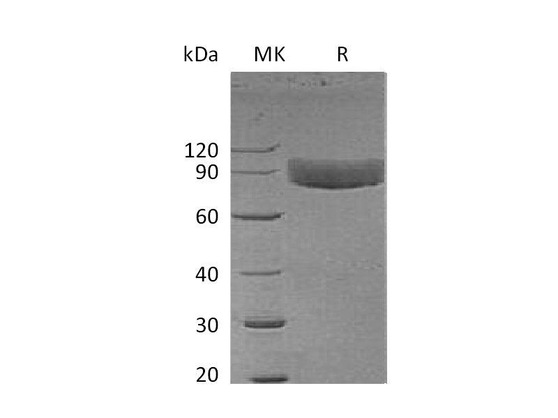 Recombinant Human IL-1R1(C-Fc)