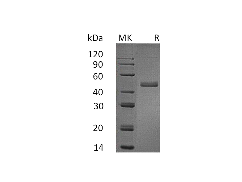 Recombinant Human IL-17B (C-Fc)