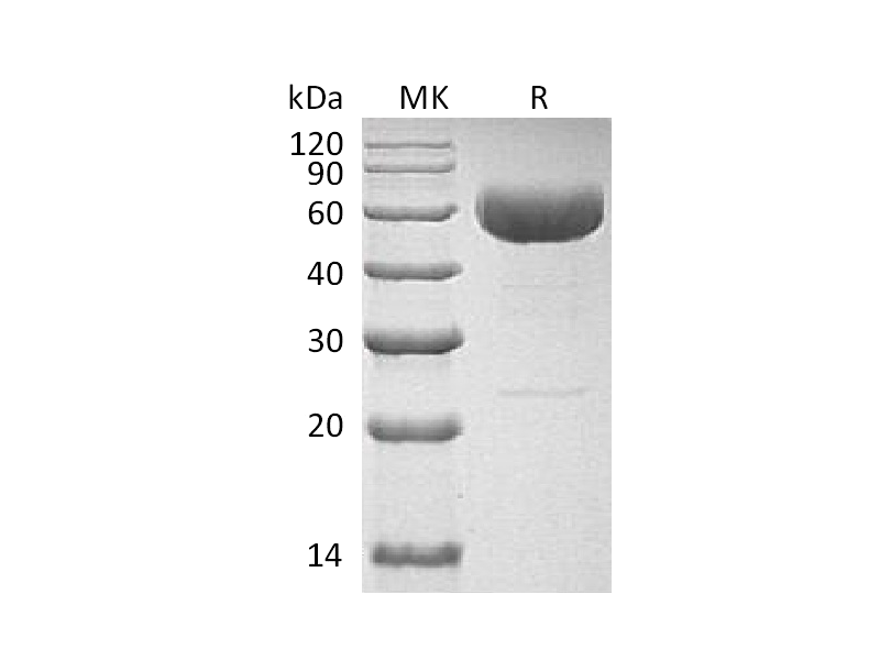Recombinant Human IL-22 (C-hIgG4 Fc)