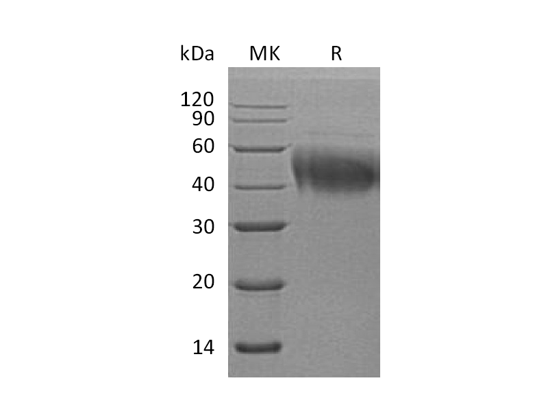 Recombinant Human IL-4 RA (C-6His)