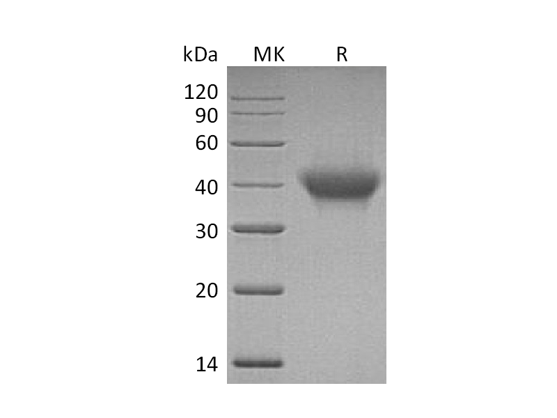 Recombinant Human IL-5RA (C-6His)