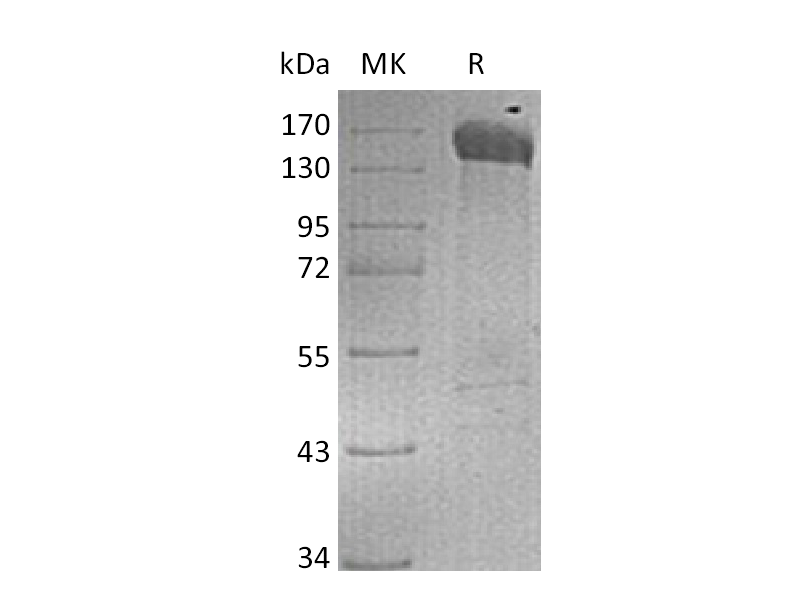Recombinant Human JAG1 (C-Fc)