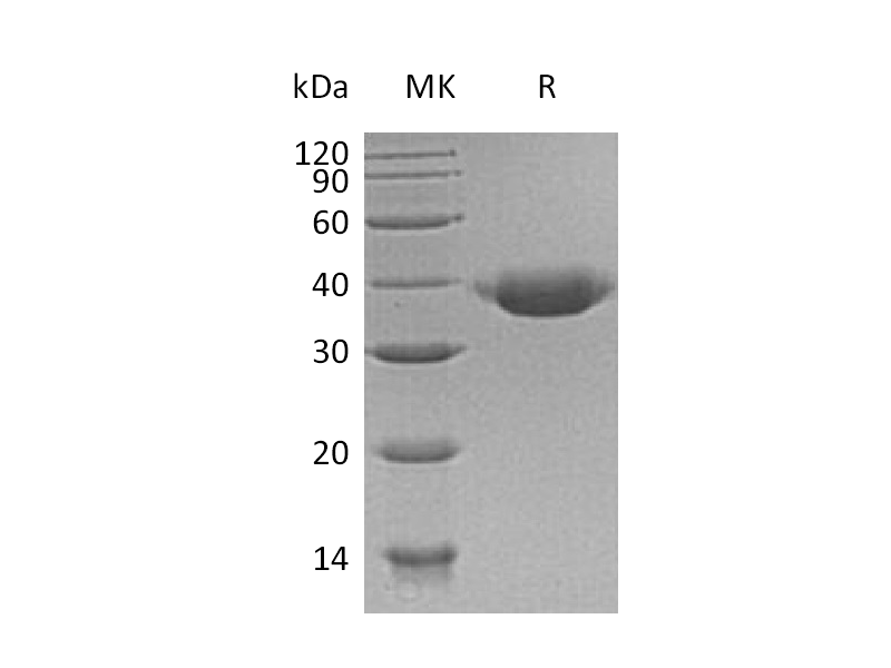 Recombinant Human JAM-B (C-6His)