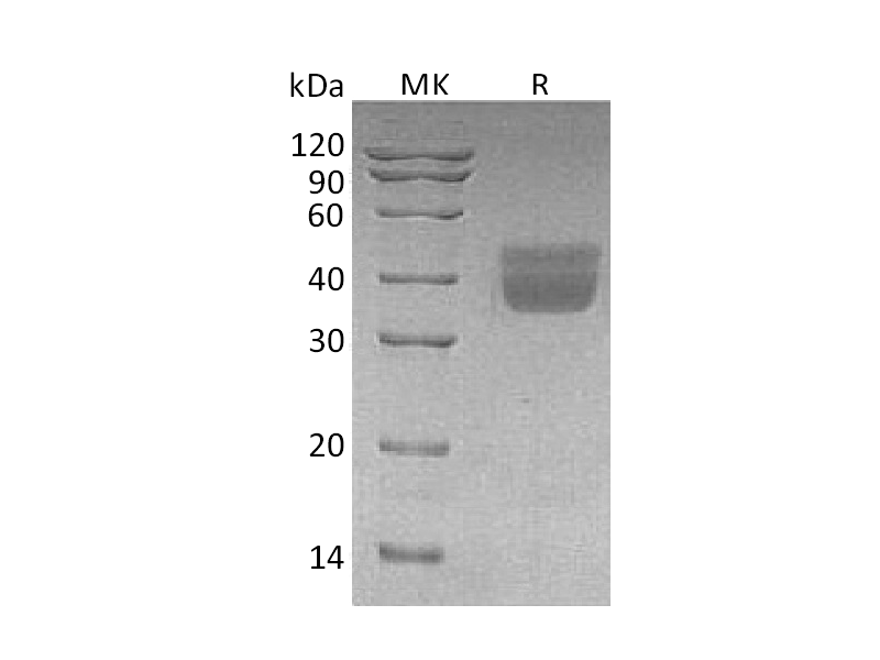 Recombinant Human KLK1 (C-6His)