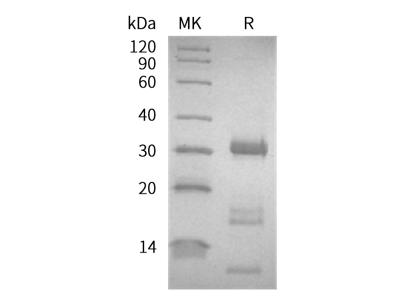Recombinant Human KLK2 (C-6His)