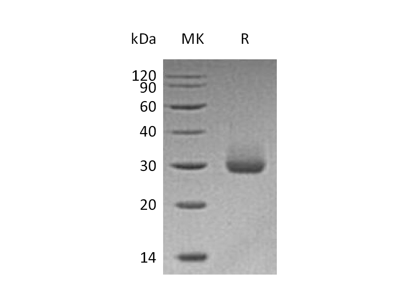Recombinant Human KLK4 (C-6His)