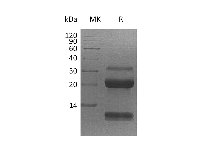 Recombinant Human KLK6 (C-6His)