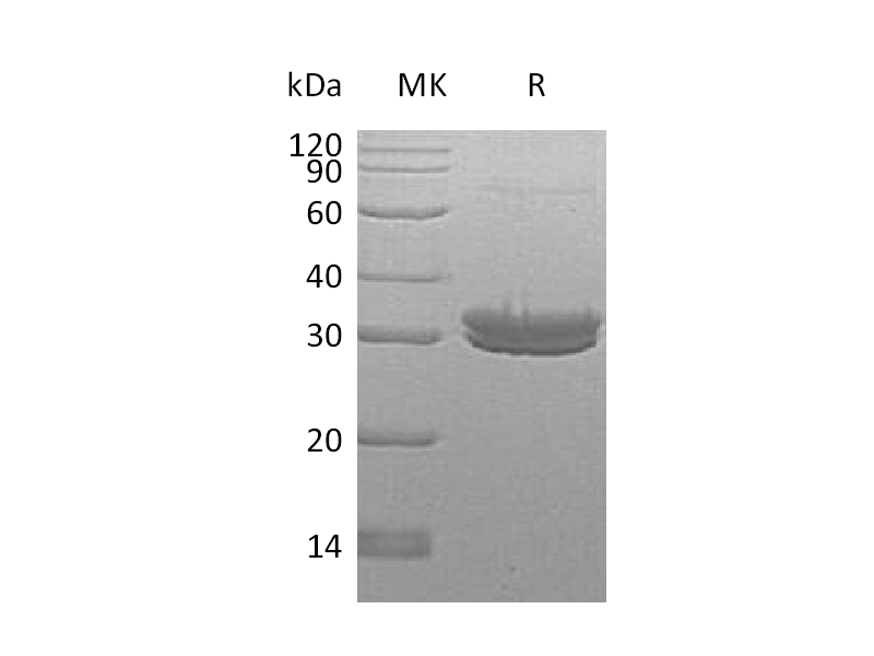 Recombinant Human KLK7 (C-6His)