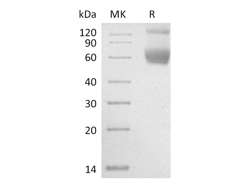 Recombinant Human Serpin A4 (C-6His)