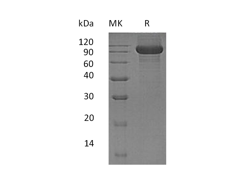 Recombinant Human Kell (C-6His)