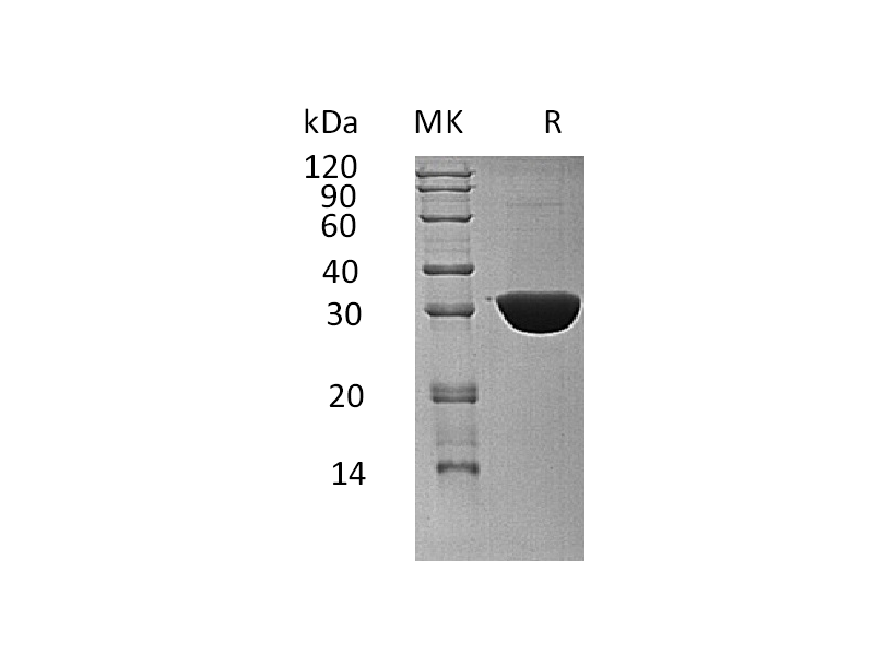Recombinant Human KHK (C-6His)