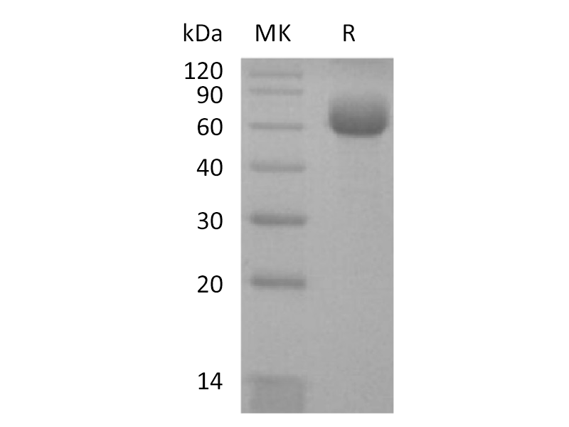 Recombinant Human CD161 (C-Fc)