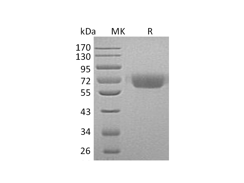 Recombinant Human KNG1 (C-6His)