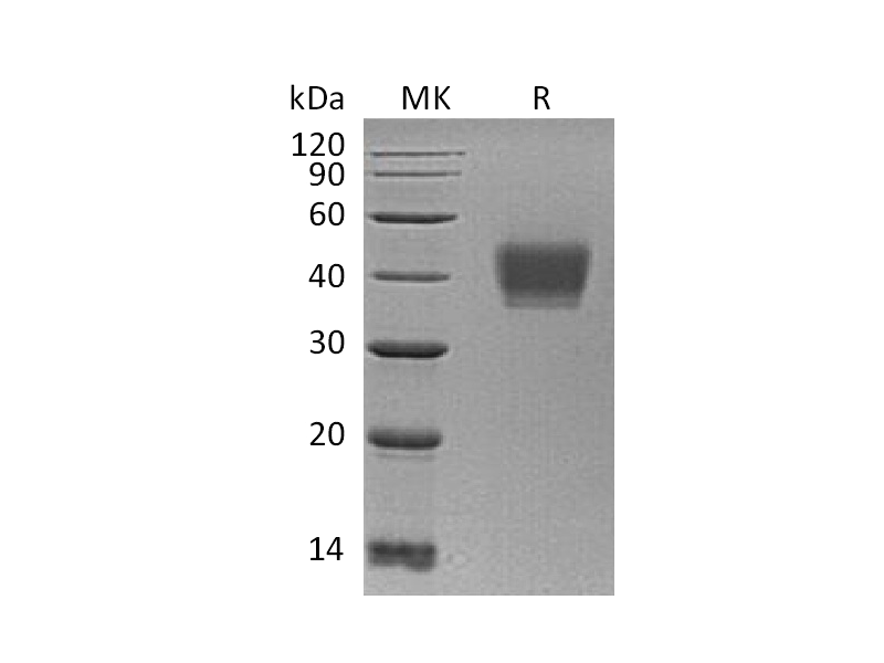 Recombinant Human KIR2DL3 (C-6His)