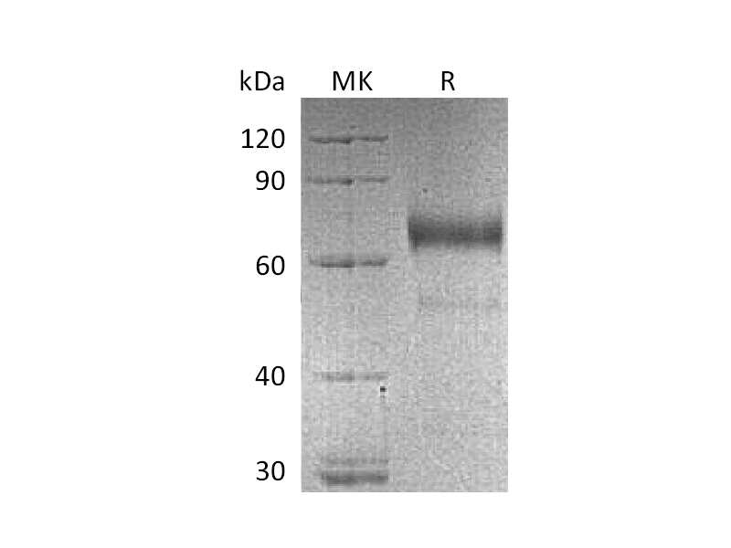 Recombinant Human KIR2DL3 (C-Fc)