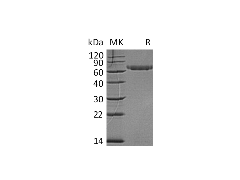 Recombinant Human LAG-3 (C-6His)