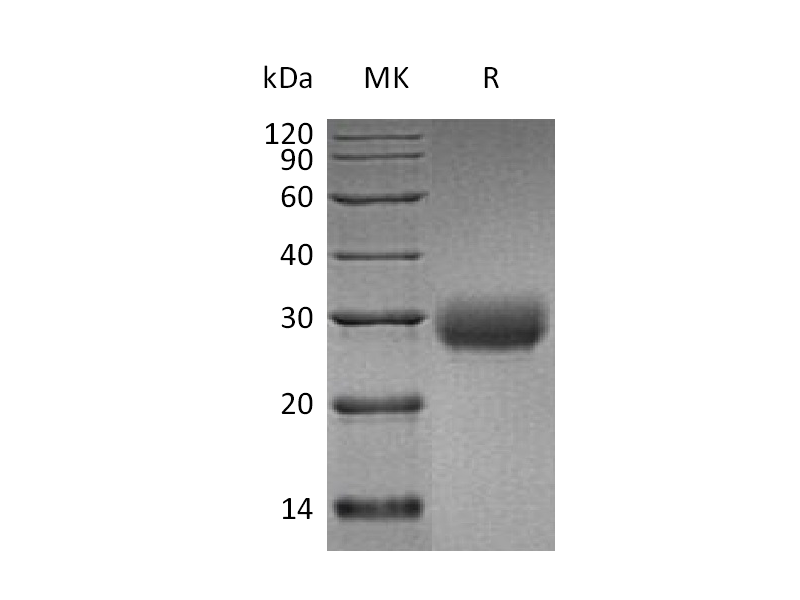Recombinant Human LAIR1 (C-6His)