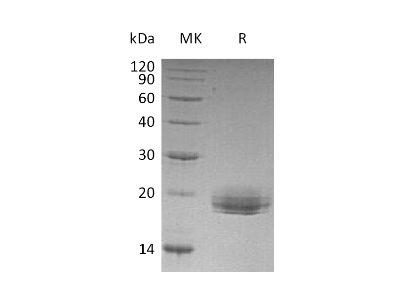 Recombinant Human LAIR2 (C-6His)
