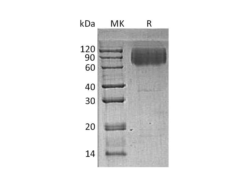 Recombinant Human LAMP2 (C-6His)