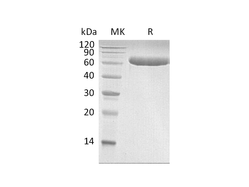 Recombinant Human LBP (C-6His)