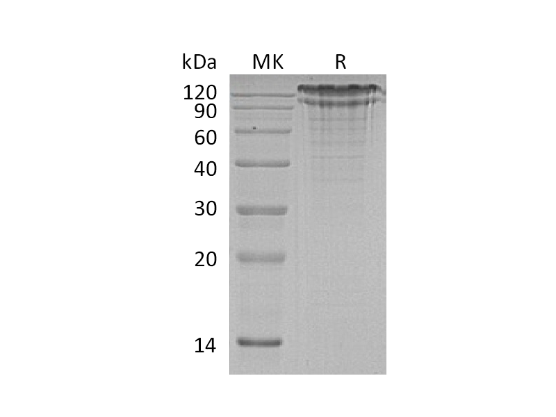 Recombinant Human LDL R (C-6His)