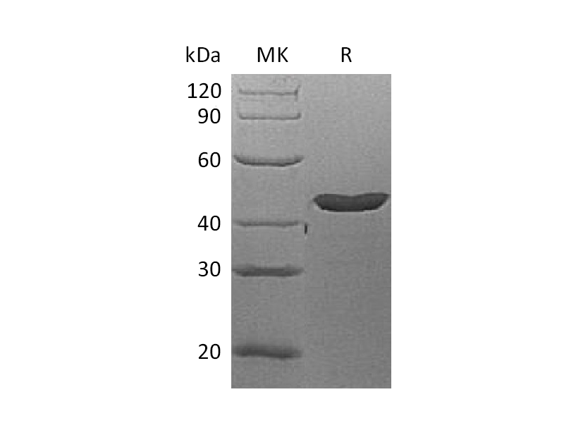 Recombinant Human Lefty-A (N-6His)