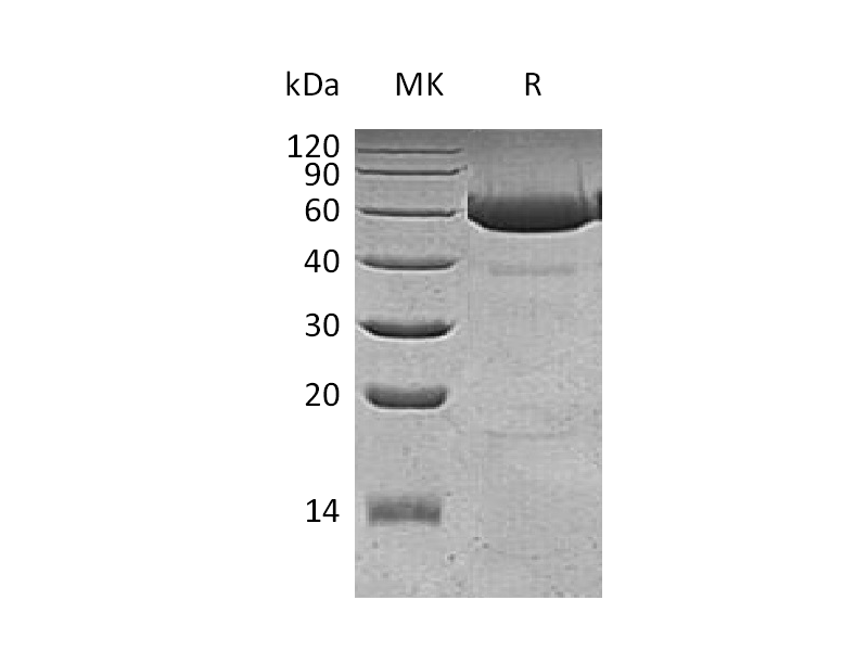 Recombinant Human Legumain (C-6His)