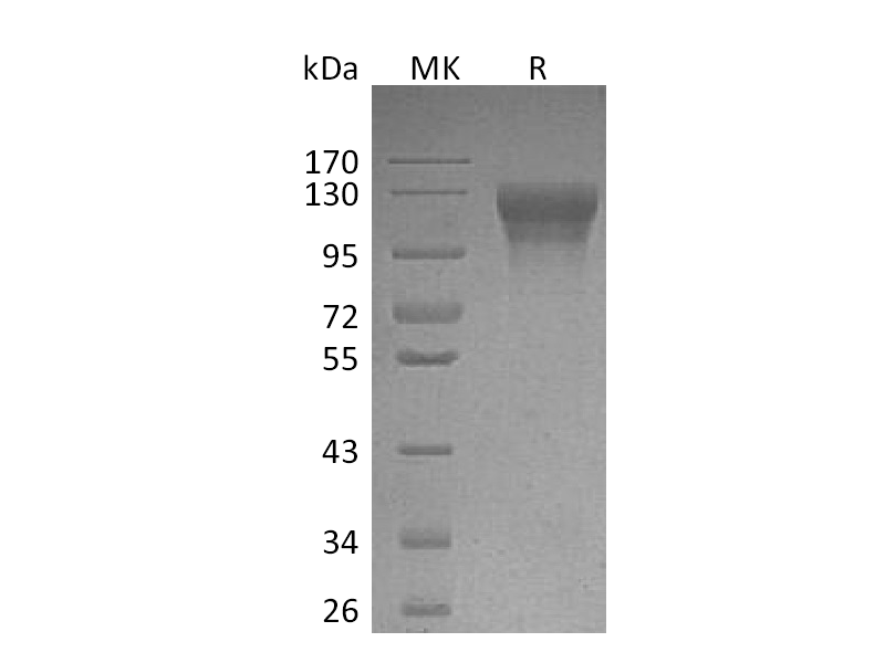 Recombinant Human LEPR (C-10His)