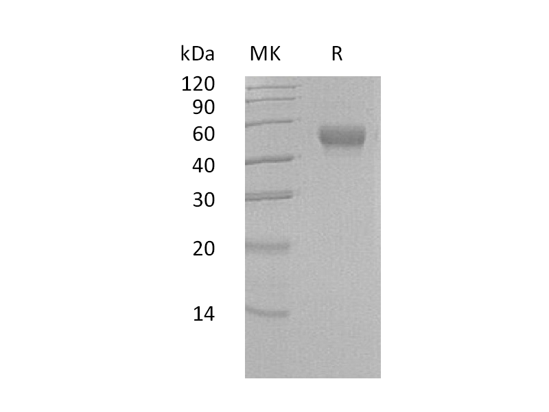 Recombinant Human LRG1 (C-6His)
