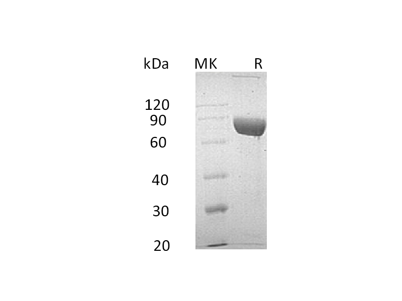 Recombinant Human LRG1 (C-Fc-6His)