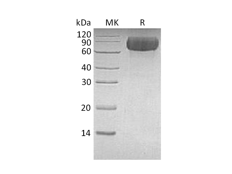 Recombinant Human LILRB1 (C-6His)