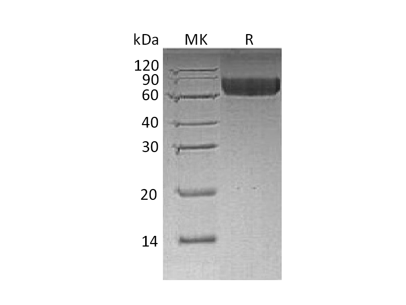 Recombinant Human LILRB2 (C-6His)