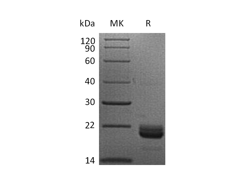 Recombinant Human LIGHT (N-6His)